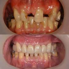 Burleigh Dentistry & Implants | 13/2 Executive Dr, Burleigh Waters QLD 4220, Australia