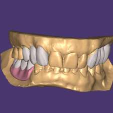 Monolithic Dental Laboratory pty ltd | suite 4/251 Latrobe Terrace, Geelong VIC 3220, Australia