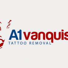 A1 Vanquish Tattoo Removals | 2/33 Kildonan St, Aspley QLD 4034, Australia