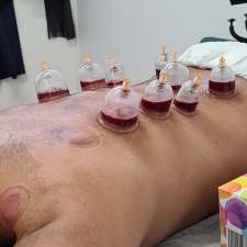 Cupping As-Sunnah | 12/58 Taylor St, Lakemba NSW 2195, Australia
