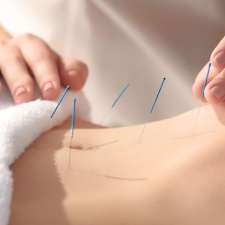 Adriana Bellicanta Acupuncture - Fertility, IVF Acupuncture | 32 Kerr St, Charlestown NSW 2290, Australia