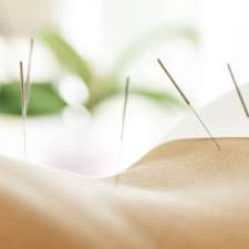 Healing with Acupuncture | 90 Mona Vale Rd, Warriewood NSW 2102, Australia