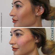 Cosmétique Cosmetic Surgery | Level 1/2/32 Myers St, Geelong VIC 3220, Australia