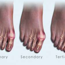 Beyond Podiatry | 5/34 John St, Warners Bay NSW 2282, Australia