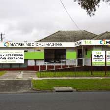 Matrix Medical Imaging Fawkner | 144 Jukes Rd, Fawkner VIC 3060, Australia