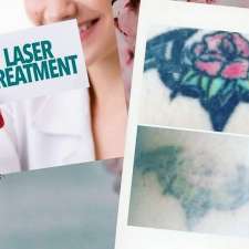 Tattoo removal lismore and beauty services | Fisher streer, Lismore NSW 2480, Australia