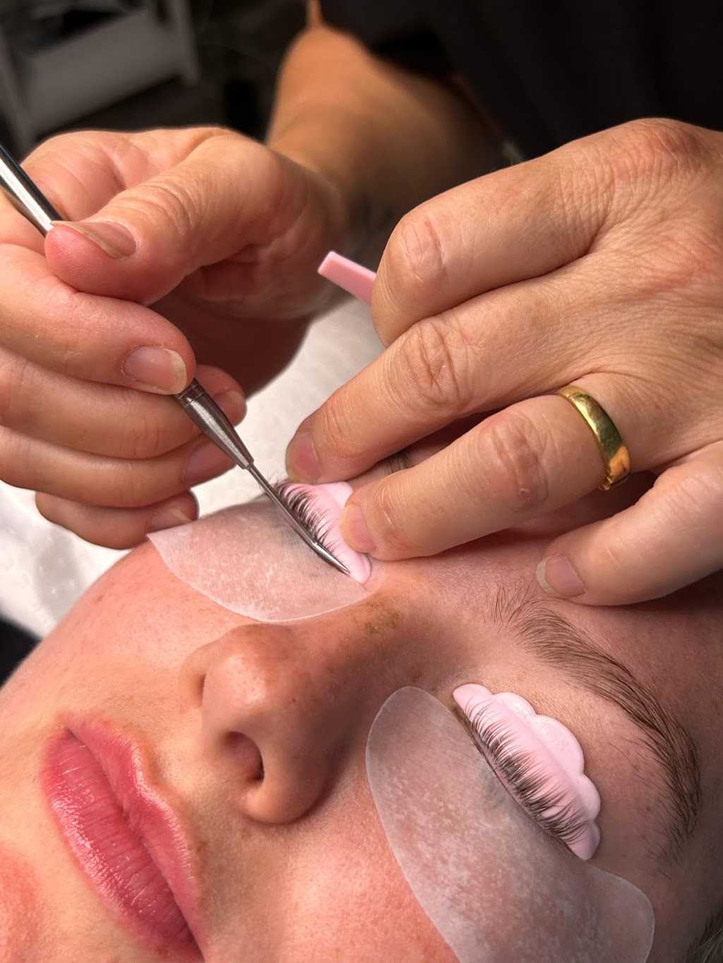 Fit Skin Clinic | 18 Steel St, Redhead NSW 2290, Australia | Phone: (02) 4955 3670