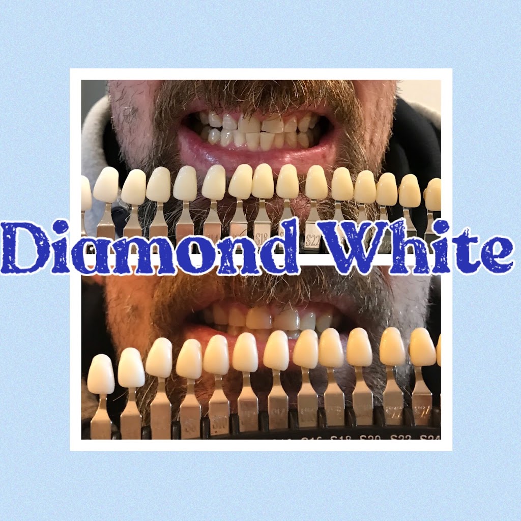 Diamond White Teeth Whitening | health | 171 Coxs Rd, North Ryde NSW 2113, Australia | 0424142848 OR +61 424 142 848
