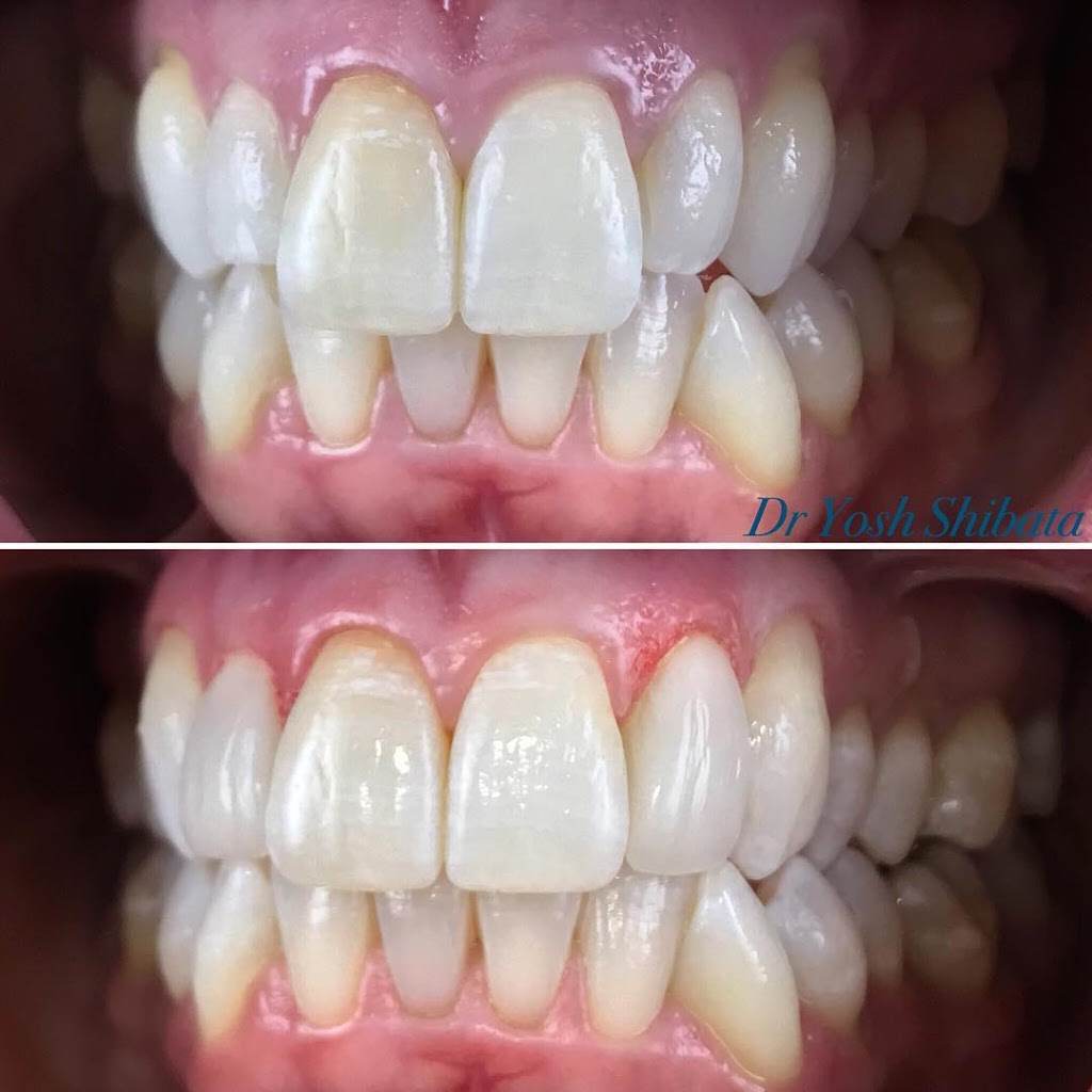 Shibata Dental | dentist | 513 Camberwell Rd, Camberwell VIC 3124, Australia | 0398890612 OR +61 3 9889 0612