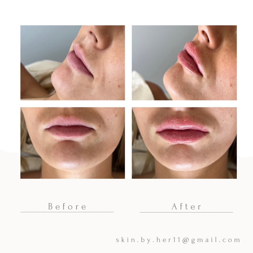 Skin By Her- Devon North | 11 Hobson Ct, Devon North VIC 3971, Australia | Phone: 0400 558 453