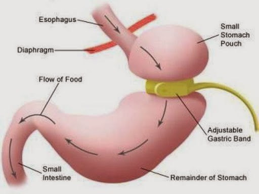 Hypnotherapy Clinic - Virtual Gastric Banding | hospital | 2 Sentry Drive, Stanhope Medical Centre, Stanhope Gardens NSW 2768, Australia | 0425305369 OR +61 425 305 369