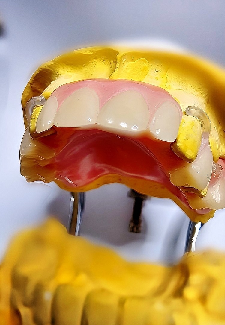 Hill End Dental Laboratory | 8 Majors Ave, Colebee NSW 2761, Australia | Phone: 0410 112 083