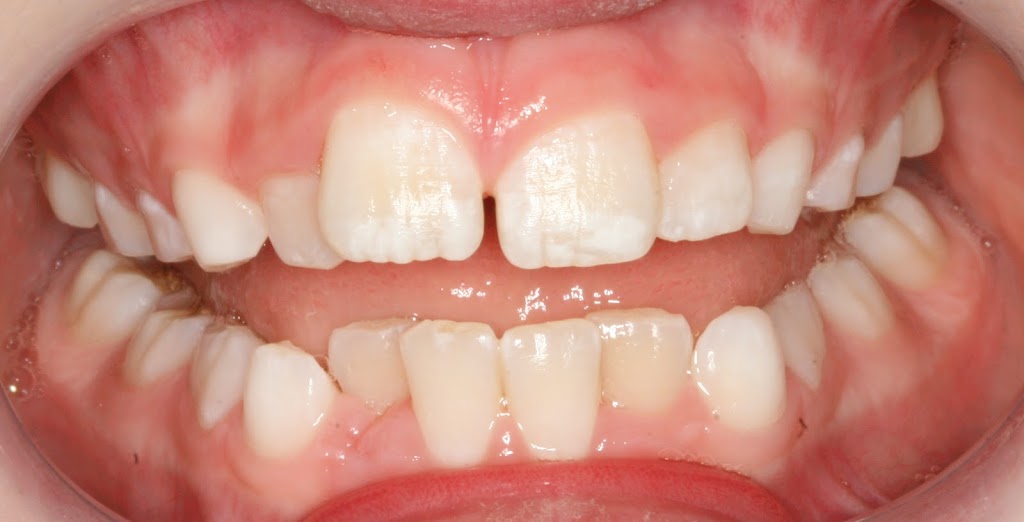 Love Your Smile Orthodontics | dentist | Suite 6 Level 1/100 Overton Rd, Williams Landing VIC 3027, Australia | 0383722005 OR +61 3 8372 2005
