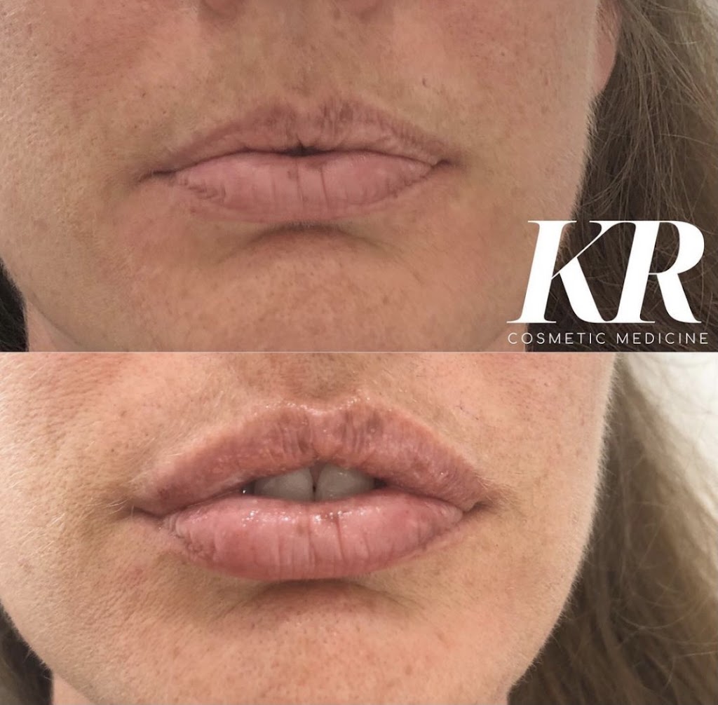 KR Cosmetic Medicine | 450 Gaffney St, Pascoe Vale VIC 3044, Australia | Phone: 0421 218 575