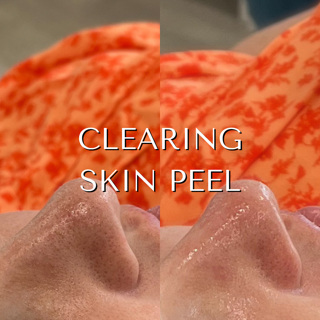 Sunlight Skin | 6 Castlereagh St, Riverstone NSW 2765, Australia | Phone: 0483 873 326