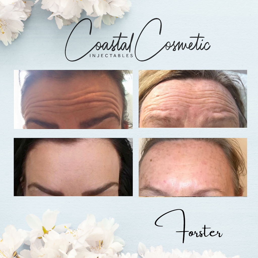 Coastal Cosmetic Injectables | spa | 12-18 Wallis St, Forster NSW 2428, Australia | 0466029818 OR +61 466 029 818