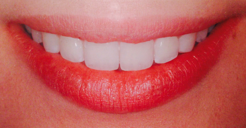 Albany Orthodontics | dentist | 4 Valencia Cl, Orana WA 6330, Australia | 0898423252 OR +61 8 9842 3252