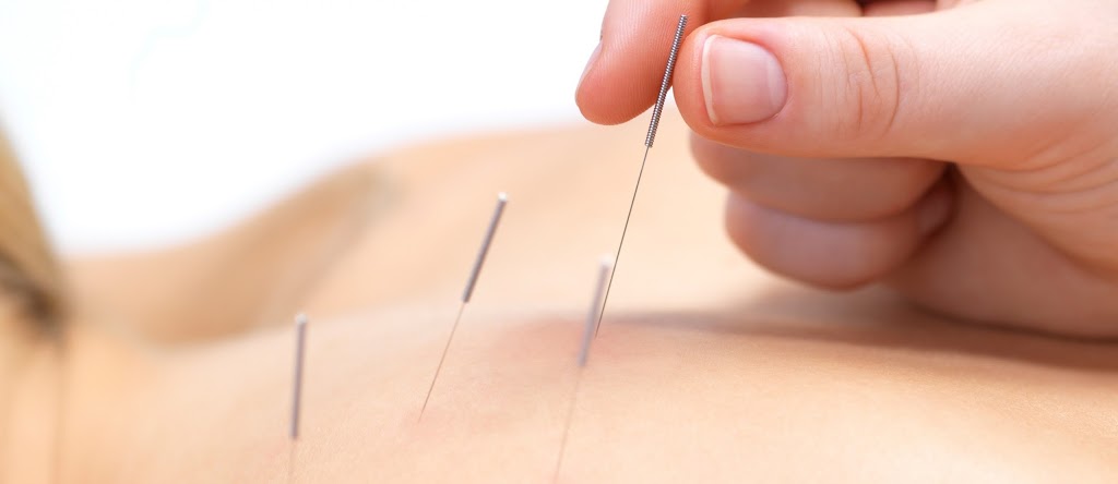 Peel Back Care Clinic - Dry Needling & Remedial Massage | health | 35 Anstruther Rd, Mandurah WA 6210, Australia | 0895352690 OR +61 8 9535 2690