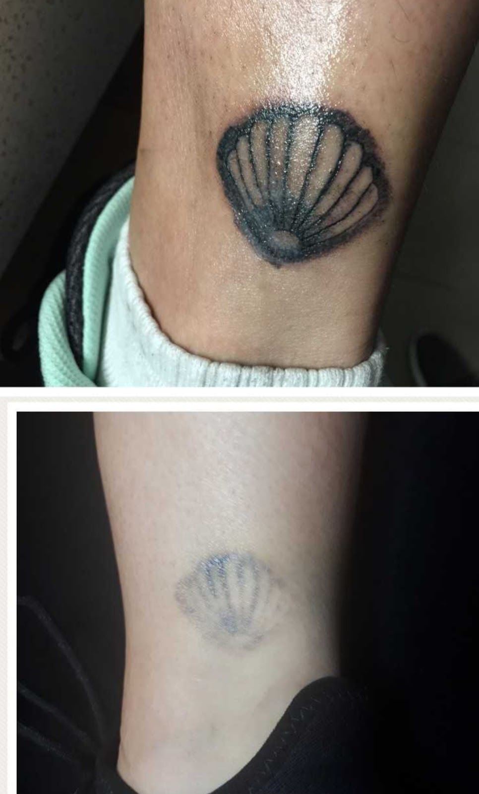 Extinct Ink Laser Treatments | store | 29 Caspian Circuit, Point Cook VIC 3030, Australia | 0405518020 OR +61 405 518 020