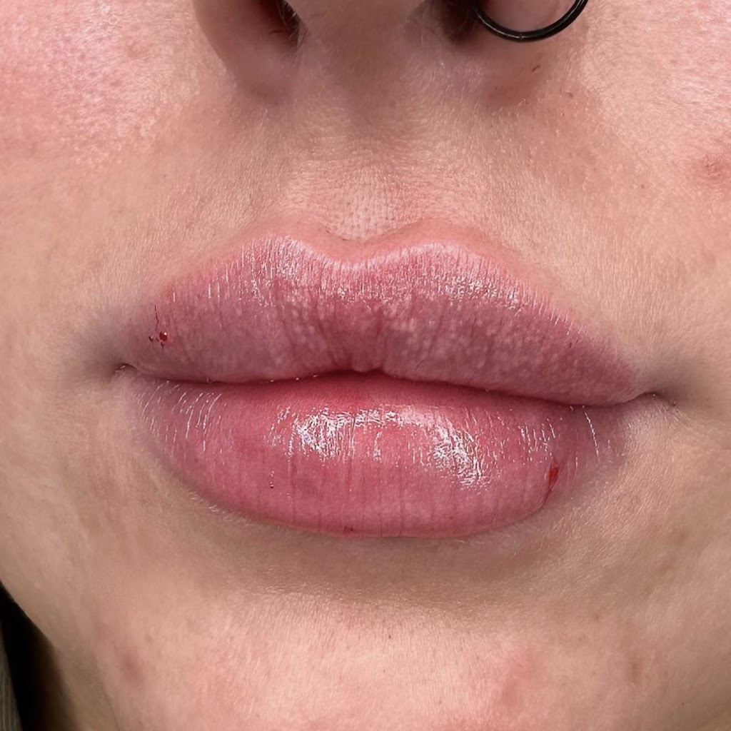 LULA AESTHETICS | 13 Harold St, Wendouree VIC 3355, Australia | Phone: 0411 667 116