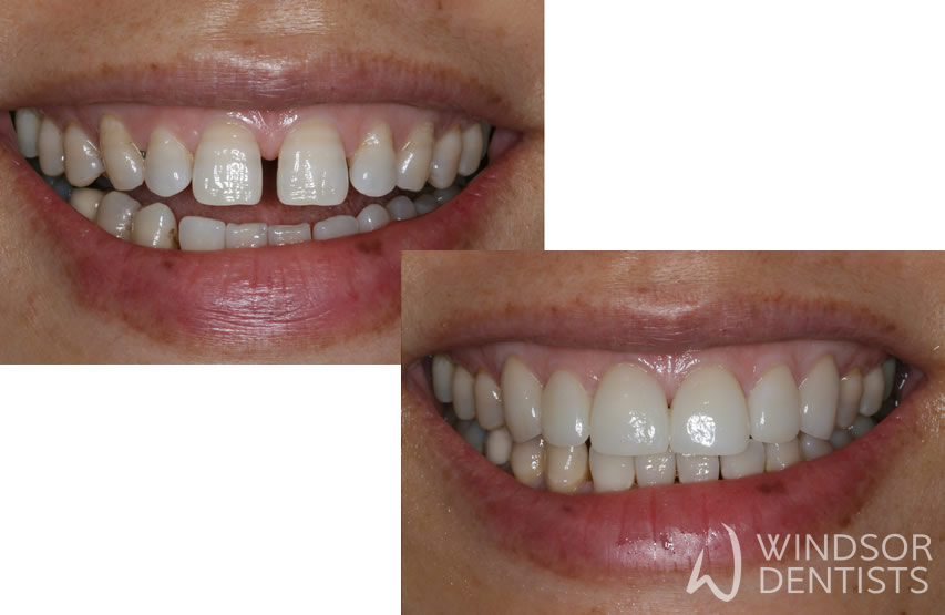 Windsor Dentists | 222 Lutwyche Rd, Windsor QLD 4030, Australia | Phone: (07) 3357 4177