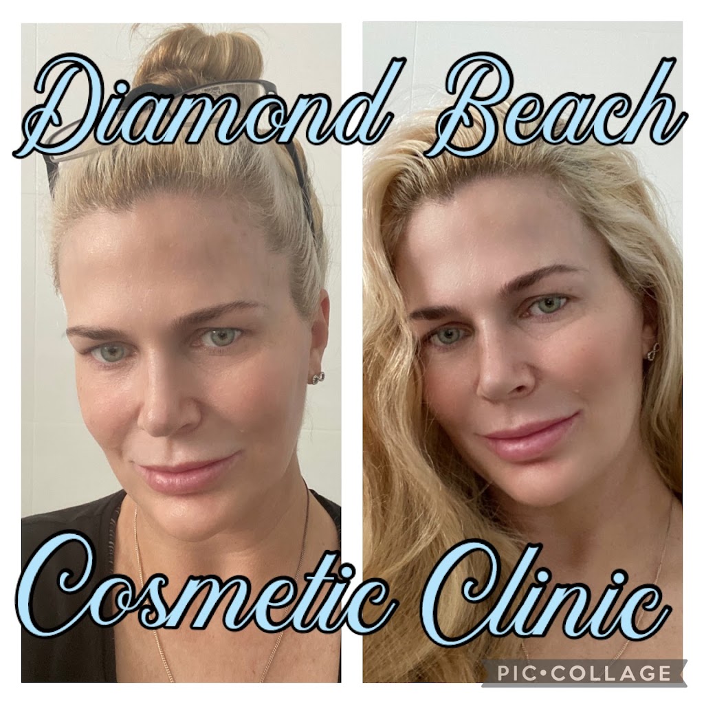 Diamond Beach Cosmetic Clinic | health | 3 Pearl Pl, Diamond Beach NSW 2430, Australia | 0431787602 OR +61 431 787 602