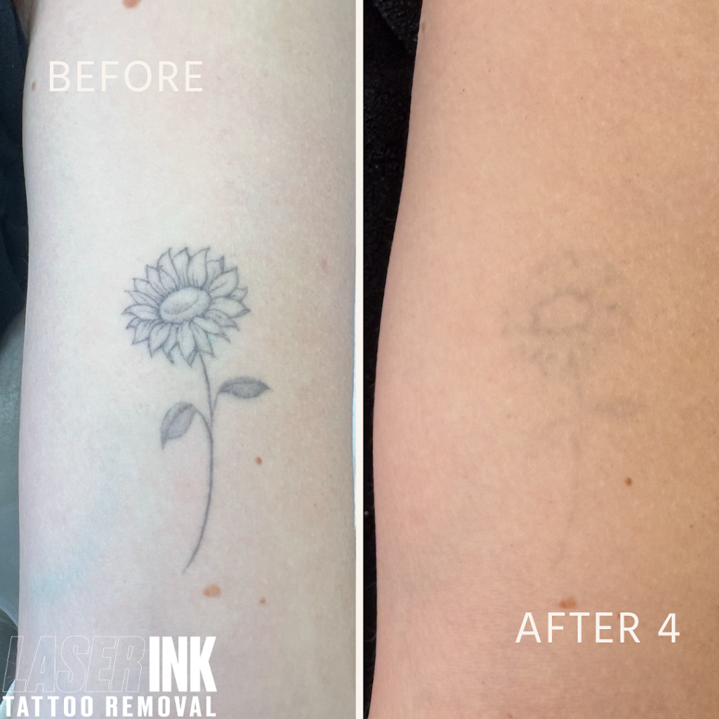 Laser Ink | 11/260 Captain Cook Dr, Kurnell NSW 2331, Australia | Phone: 0413 850 148