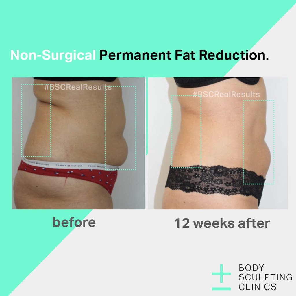 Body Sculpting Clinics - Macquarie Centre | spa | Shop 4416, Level 4, Macquarie Centre Crn Herring Rd and, Waterloo Rd, North Ryde NSW 2113, Australia | 0298781496 OR +61 2 9878 1496