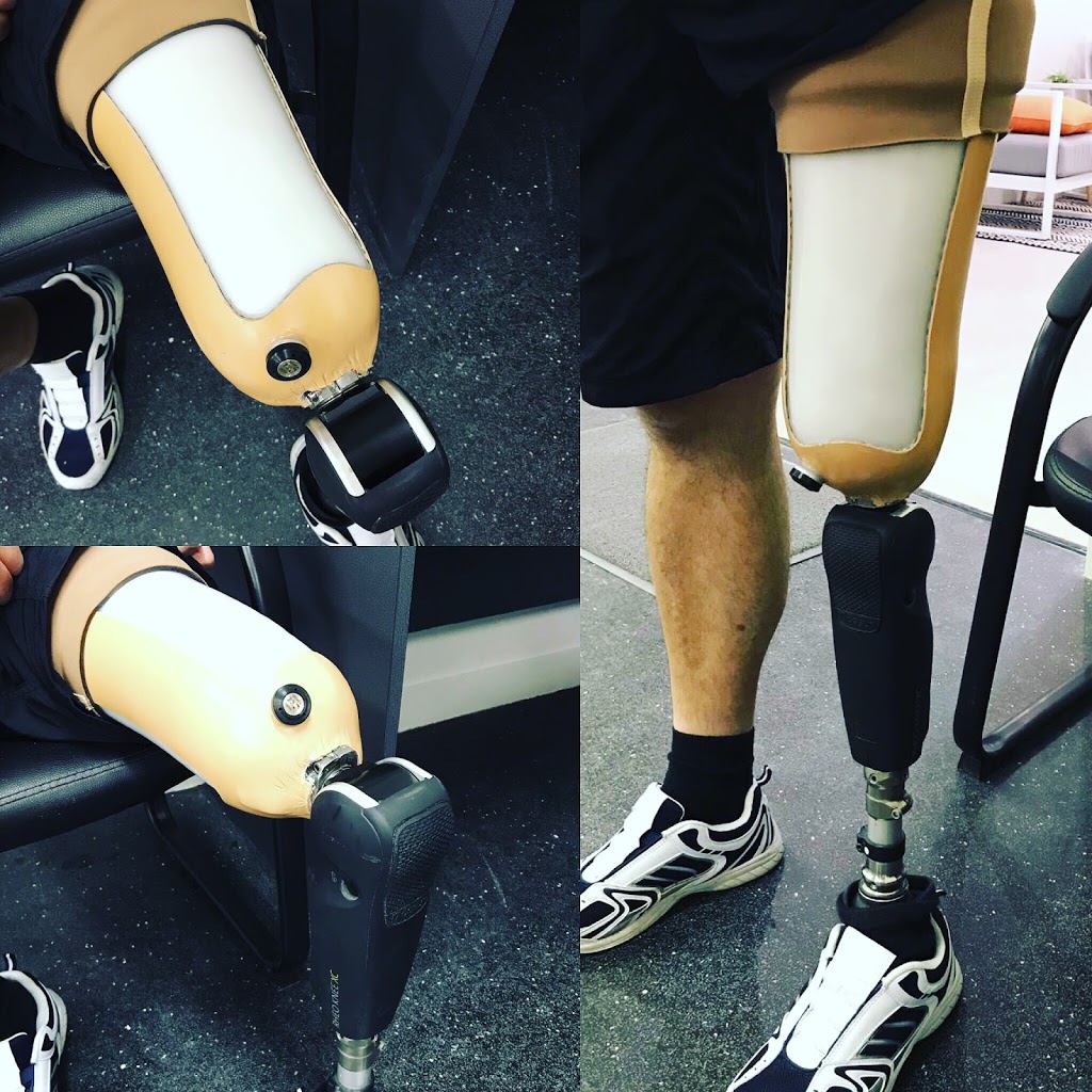 Dynamic Prosthetics & Orthotics Pty Ltd | 29A Mathew St, Nambour QLD 4560, Australia | Phone: (07) 5441 5135