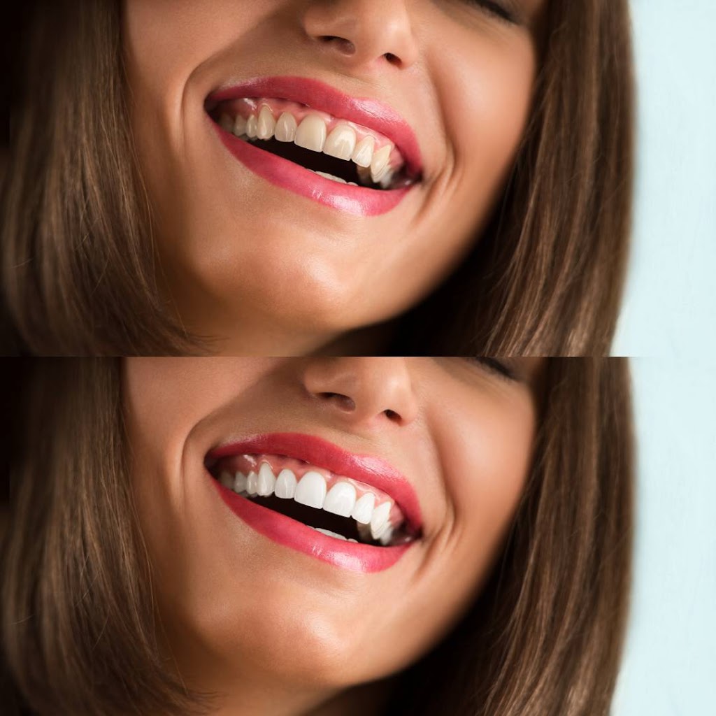 Radiant Smiles Dental Care Yokine | dentist | 198 Wanneroo Rd, Yokine WA 6060, Australia | 0894403654 OR +61 8 9440 3654