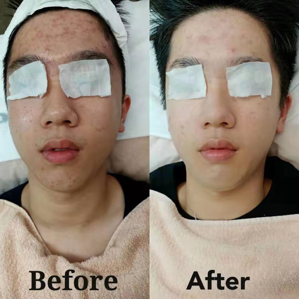 Aimei Beauty | 118 James St, Templestowe VIC 3108, Australia | Phone: 0424 878 530