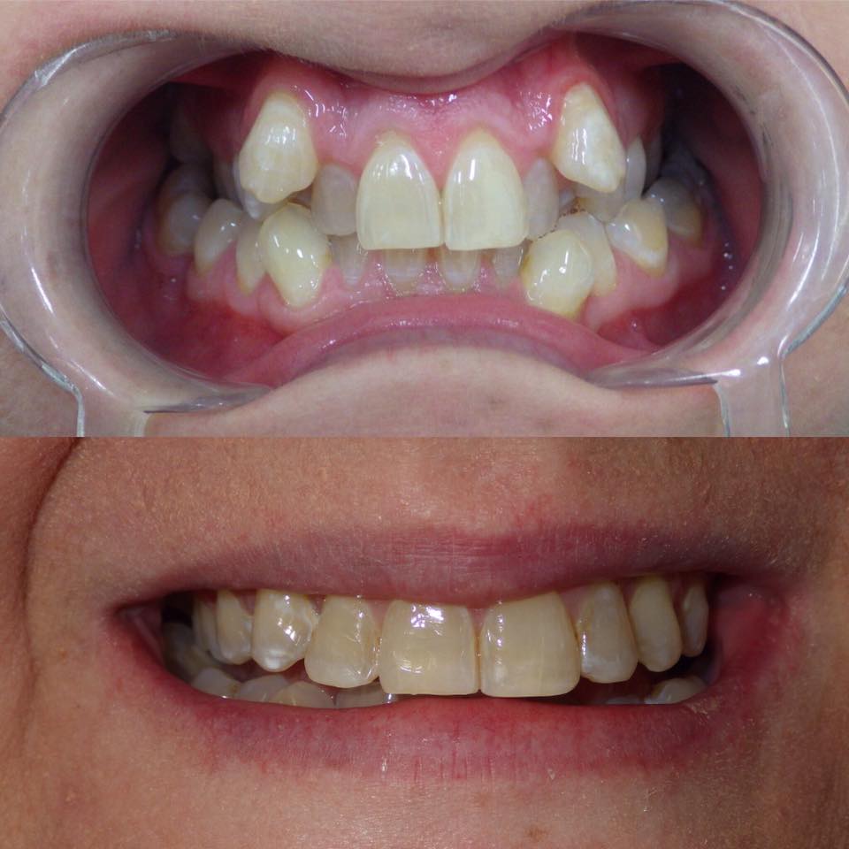 Erskine Park Dental | dentist | Swallow Dr & Peppertree Dr, Erskine Park NSW 2759, Australia | 0296704008 OR +61 2 9670 4008