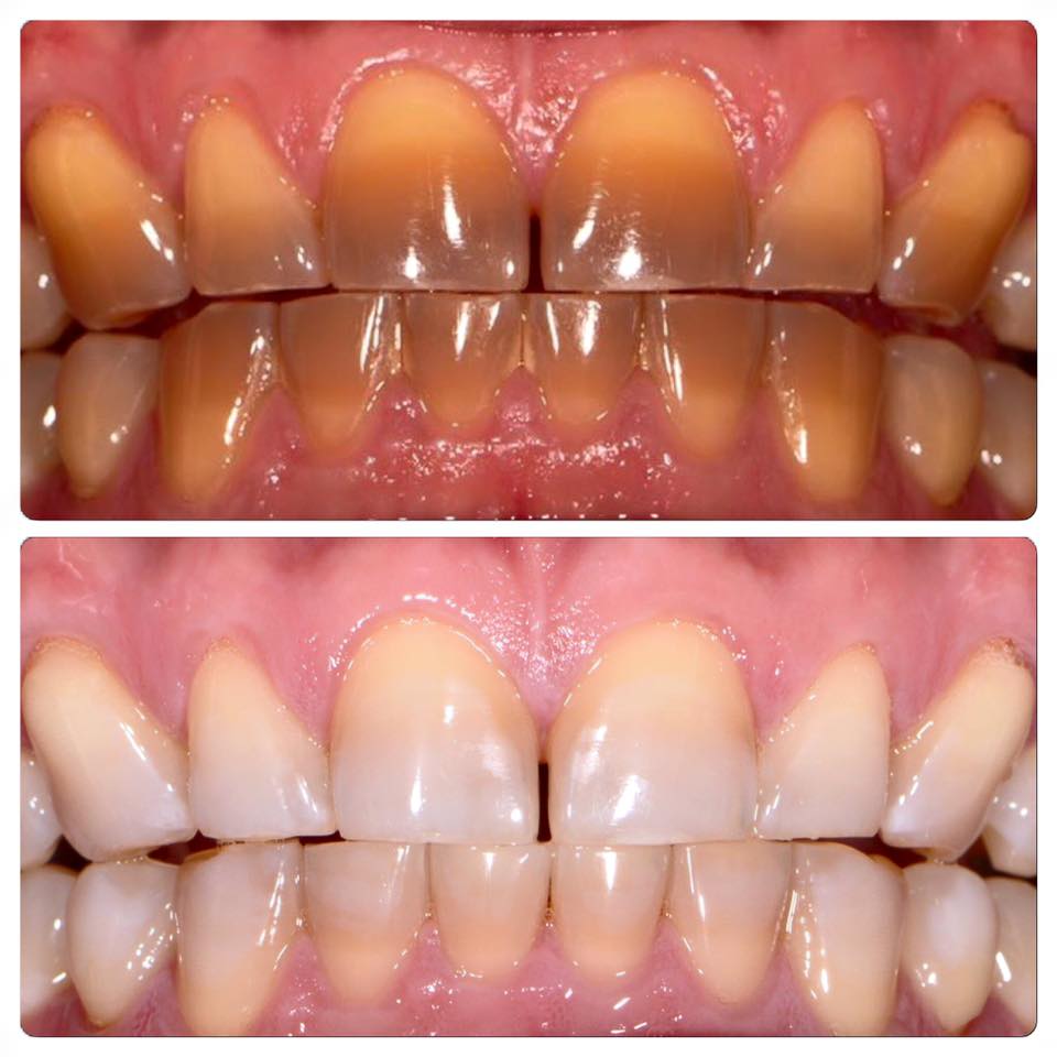 Wangaratta Dental Clinic-Vei Nee Phoon DR | 38 Reid St, Wangaratta VIC 3677, Australia | Phone: (03) 5721 3763