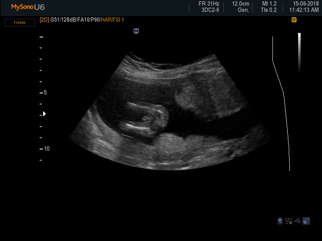 Miracle Beginnings 3D 4D Ultrasound | health | 17 Pyrus Pl, Redland Bay QLD 4165, Australia | 0412679932 OR +61 412 679 932