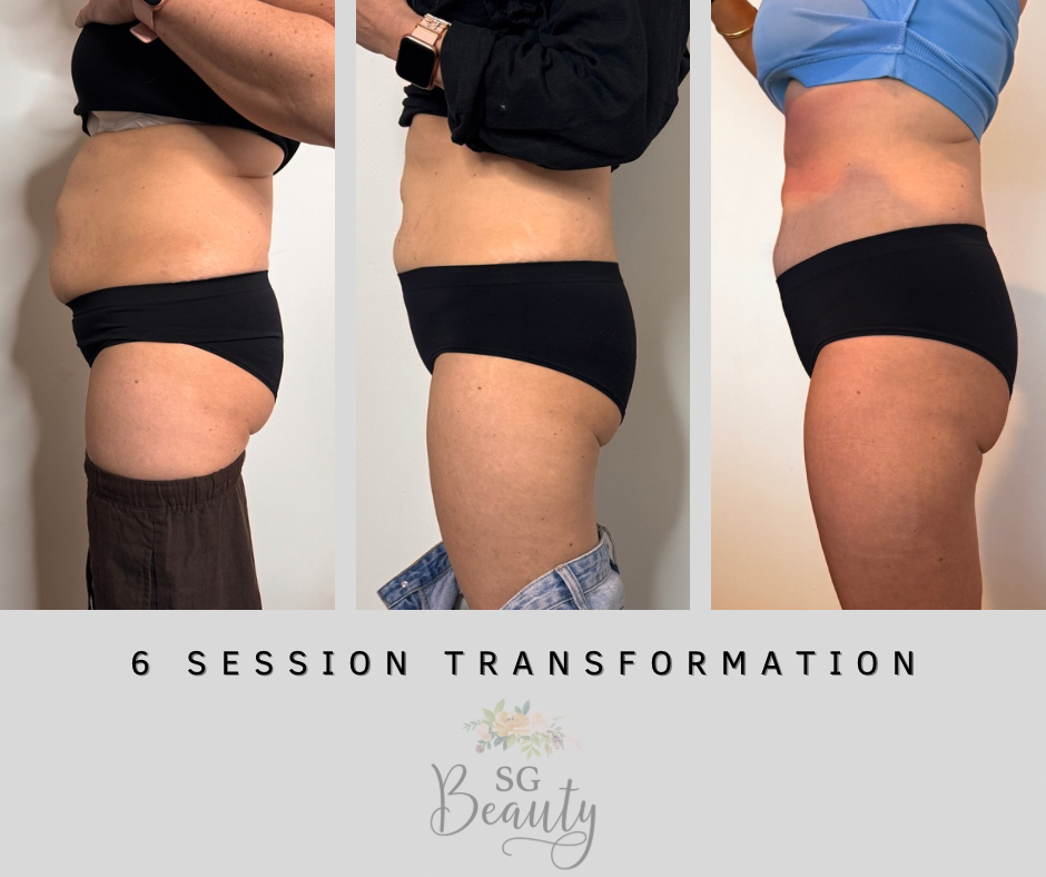 SG Beauty | 1 Freda Ct, Narre Warren VIC 3805, Australia | Phone: 0434 093 472