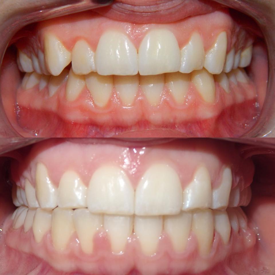 Oasis Orthodontics | dentist | 11/61 Ocean Keys Blvd, Clarkson WA 6030, Australia | 0861691699 OR +61 8 6169 1699