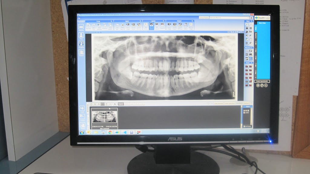 Carlton Dental Care | dentist | 633 Lygon St, Princes Hill VIC 3054, Australia | 0393805886 OR +61 3 9380 5886