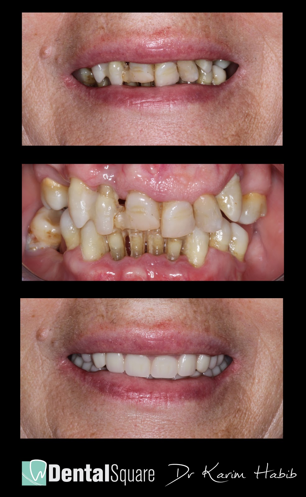 Dental Square | dentist | 5 Chatham Rd, West Ryde NSW 2114, Australia | 0280682109 OR +61 2 8068 2109
