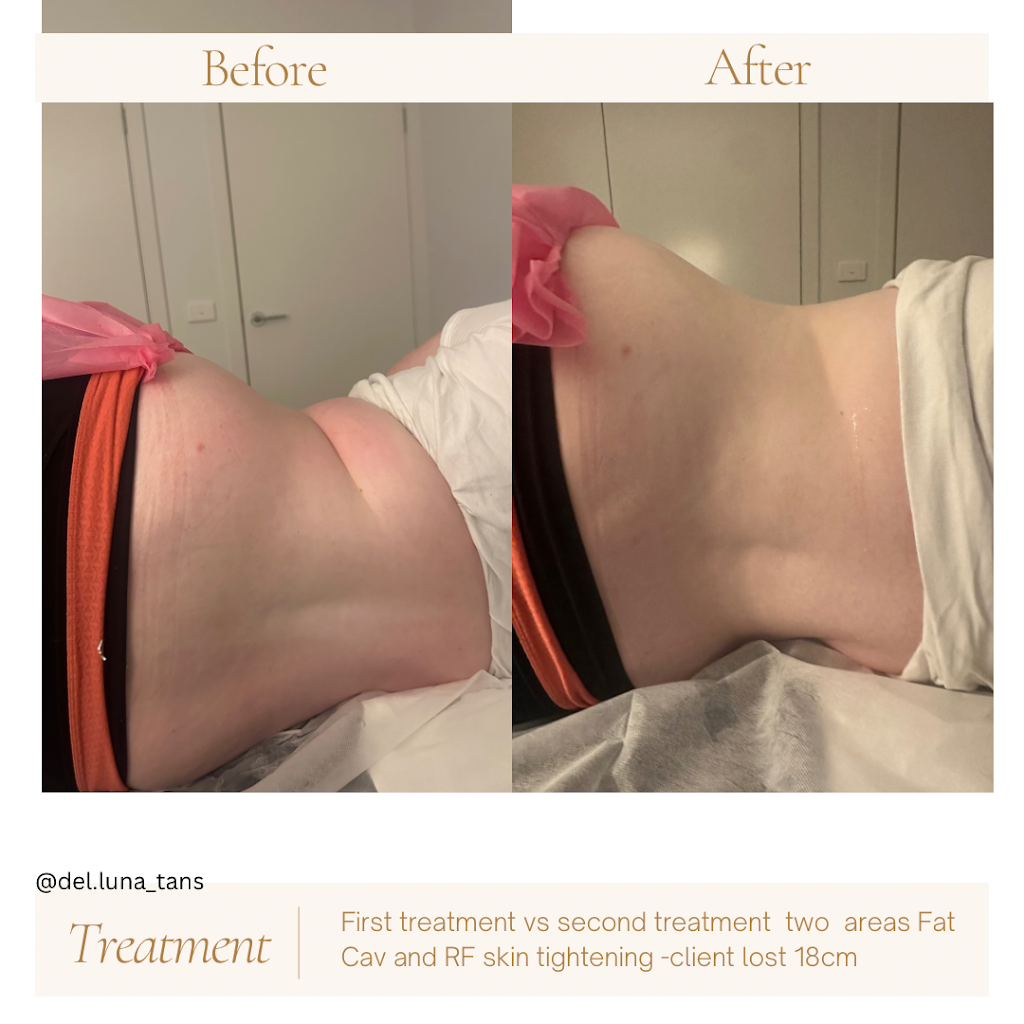 Del Luna Tans | Unit 1/1b Dodemaides Rd, Trafalgar VIC 3824, Australia | Phone: 0413 214 323