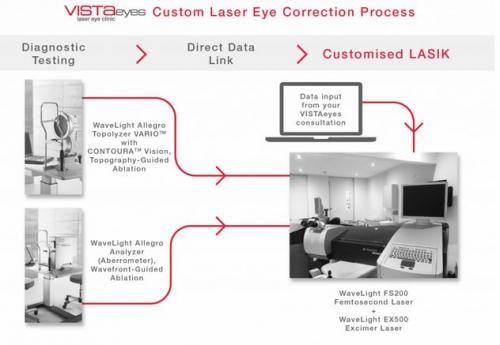 Vista Eyes Laser Eye Clinic | 1 Ross St, Elsternwick VIC 3185, Australia | Phone: (03) 8532 5000