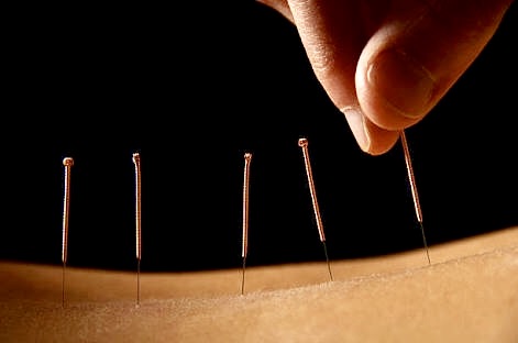 Ipswich Acupuncture Practice | health | 70 Falvey St, Ripley QLD 4306, Australia | 0420553530 OR +61 420 553 530