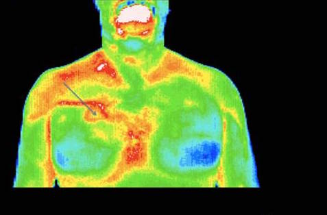 Thermo-Med Australia - Medical Thermography | health | 50 Blytheswood Ave, Warrawee NSW 2074, Australia | 0419144837 OR +61 419 144 837
