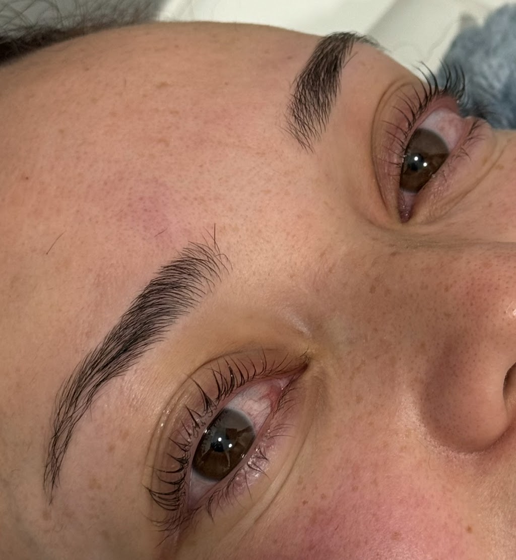 Laser By Zara | 1 Inverness Cct, Cecil Hills NSW 2171, Australia | Phone: 0420 770 846