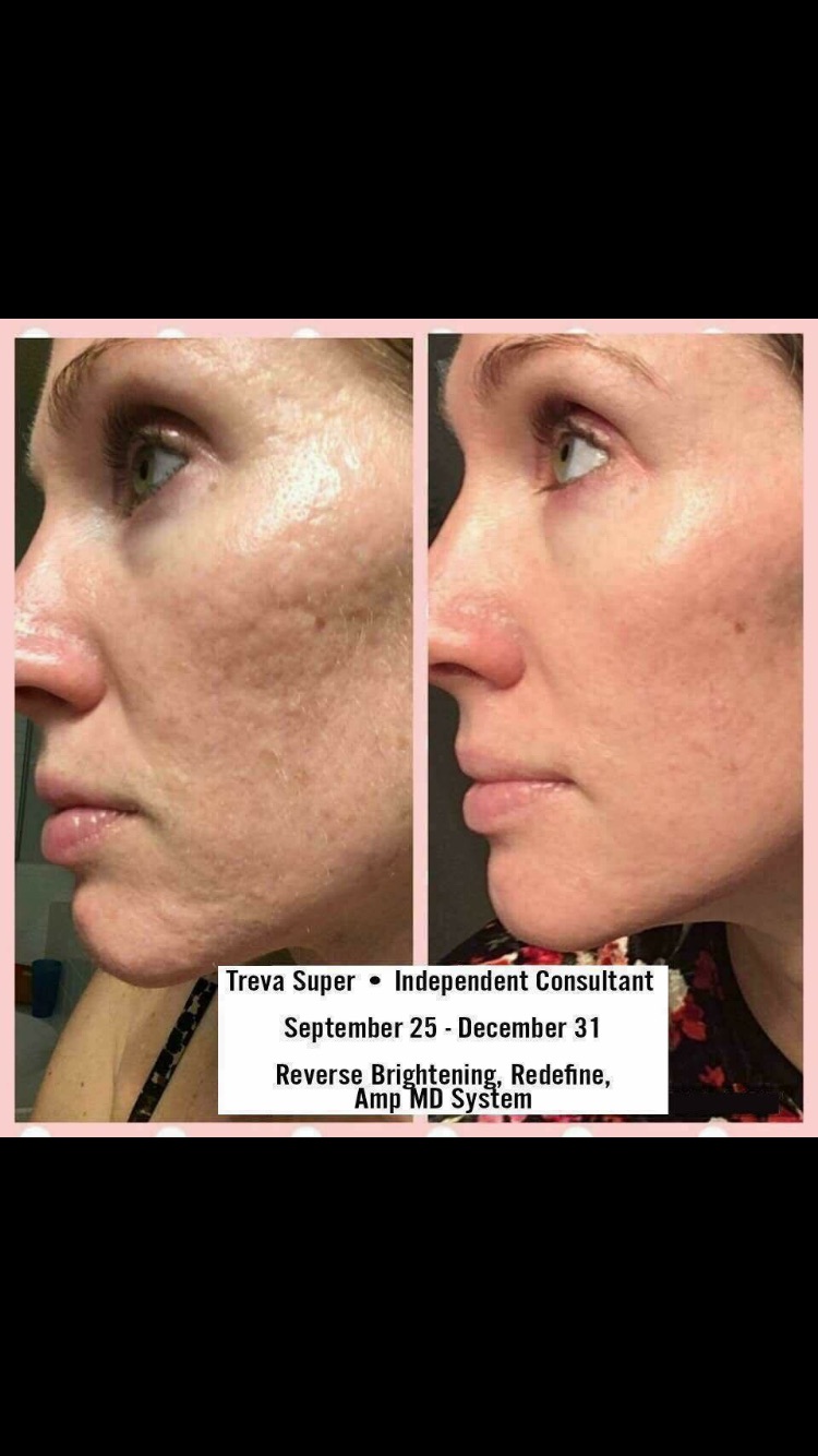 Rodan + Fields Skincare - Mel Ashton | 15 Brisbane Pl, Cromer NSW 2099, Australia | Phone: 0435 730 565