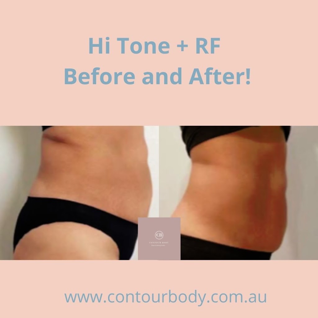 Contour Body Malvern | 413 Waverley Rd, Malvern East VIC 3145, Australia | Phone: 0428 942 075