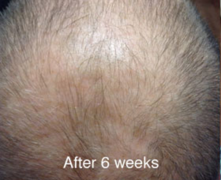Fierce Hair Growth - Campbelltown | hair care | 5/121 Queen St, Campbelltown NSW 2560, Australia | 1300343723 OR +61 1300 343 723