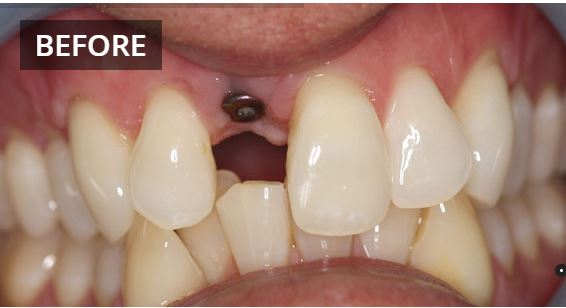 Gymea Dental | dentist | 107 Gymea Bay Rd, Gymea NSW 2227, Australia | 0295246348 OR +61 2 9524 6348