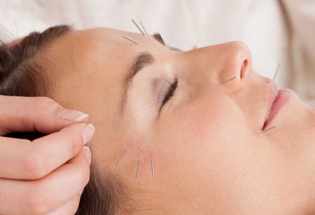 Glow Cosmetic Acupuncture | health | 2 Haystacks Dr, Torquay VIC 3228, Australia | 0422550256 OR +61 422 550 256