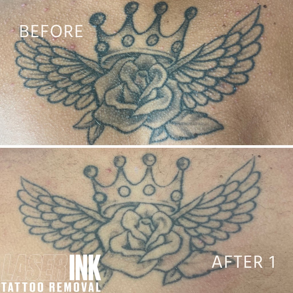 Laser Ink | 11/260 Captain Cook Dr, Kurnell NSW 2331, Australia | Phone: 0413 850 148