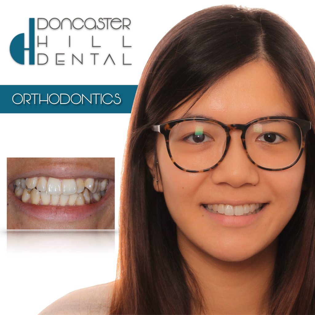 Doncaster Hill Dental | dentist | 702A Doncaster Rd, Doncaster VIC 3108, Australia | 0398402963 OR +61 3 9840 2963